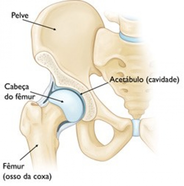 Fisioterapia na Artroplastia de quadril