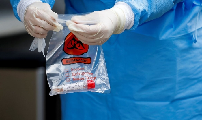 Covid-19: estudo indica que maioria de infectados cria anticorpos