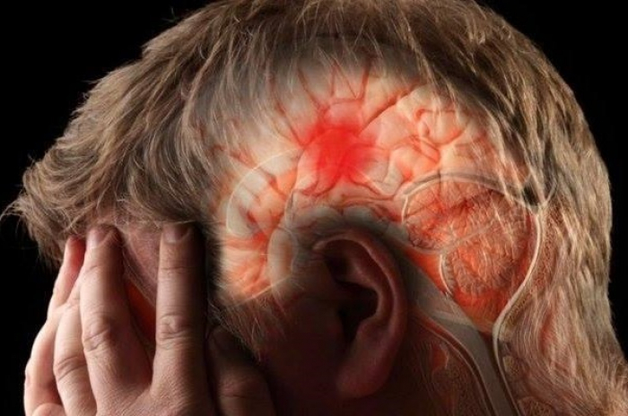 Lembrado hoje, Dia Mundial do AVC serve de alerta à população