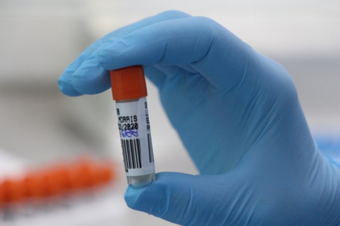 SC investiga 12 casos suspeitos de reinfecção pelo coronavírus