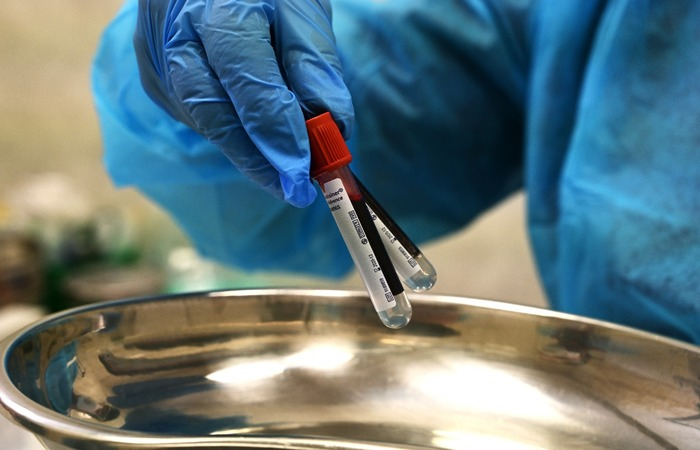 Covid: SC tem menor número de casos ativos desde fevereiro